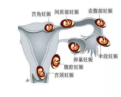 广州代孕妇孕期做运动的话动作宜缓