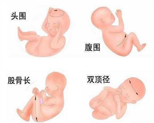香港供卵助孕：荨麻疹可以代孕吗1