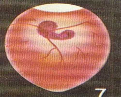 活血助孕丸：孕期长痘，这种祛痘产品绝不能用
