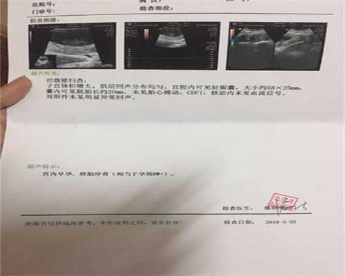 广州试管婴儿代孕价格：患唐氏综合症的孕妇有
