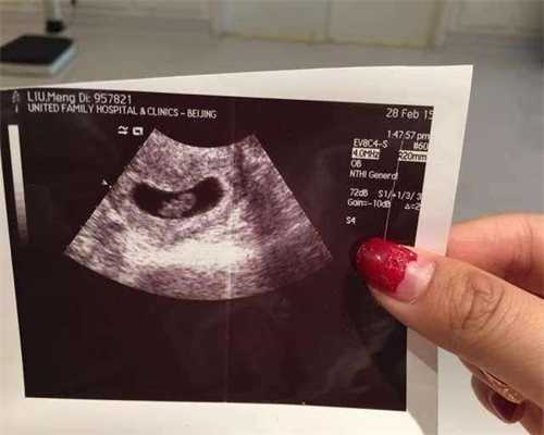 广州找代孕生小孩要多少钱：代孕不到一个月能