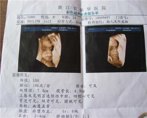 广州地下代孕市场调查：梦见自己代孕打胎成功