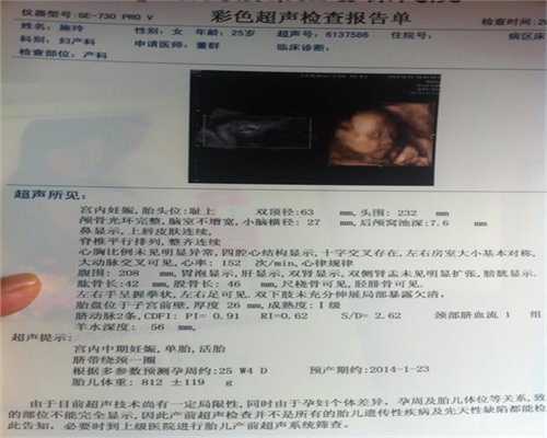 广州代孕价格多少：一般安全期会代孕吗
