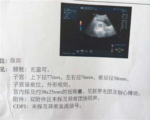 广州代孕上门洽谈：医疗风险医院在孕检唐氏筛