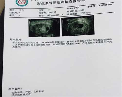 最好的广州代孕医院：子宫肌瘤诊断要点有哪些