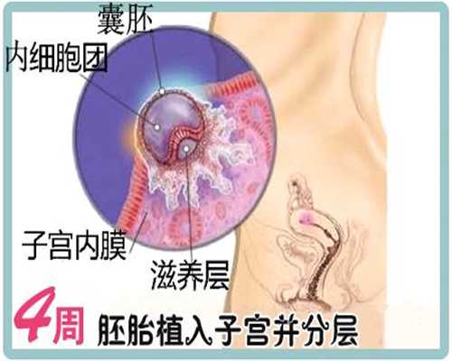 广州孕宝助孕：哪家医院治疗不孕不育效果好呢