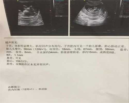 广州找代孕女孩：滴虫性阴道炎的症状表现，你