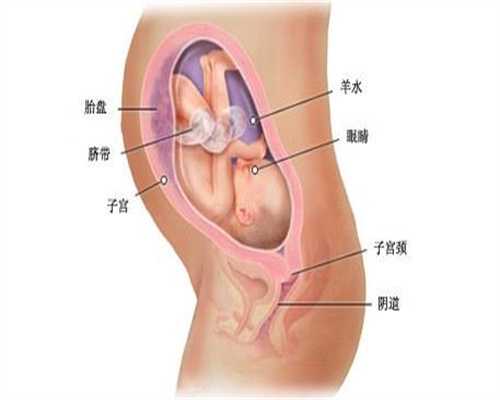辅助代孕：多囊卵巢综合症的病因是什么，能治