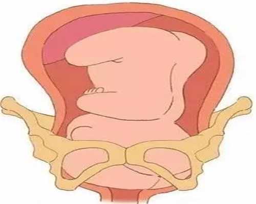 在哪找代孕志愿者：卵巢囊肿的早期症状有哪些