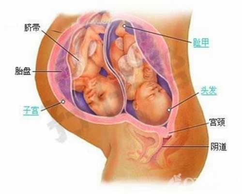 本人找代孕妈妈：女性如何预防输卵管积水