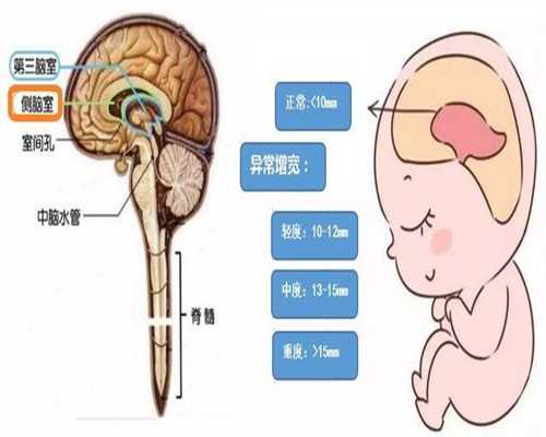 广州代孕条件：[试管婴儿]双胞胎！我的两个普胚
