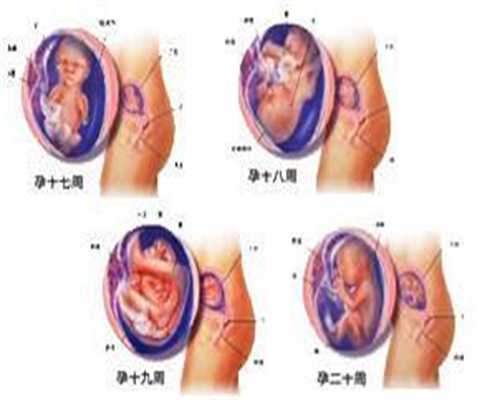 珠海代孕：无精症不育的症状表现是什么？