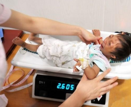 2009年，湖南女子生下2斤重的“小猴子”，坐出租车被拒：坐不下
