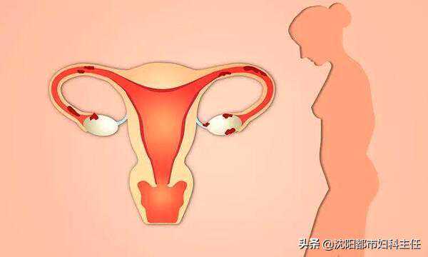 这里有一些女性“卵巢早衰”的表现，出现了要引起注意，不要忽视